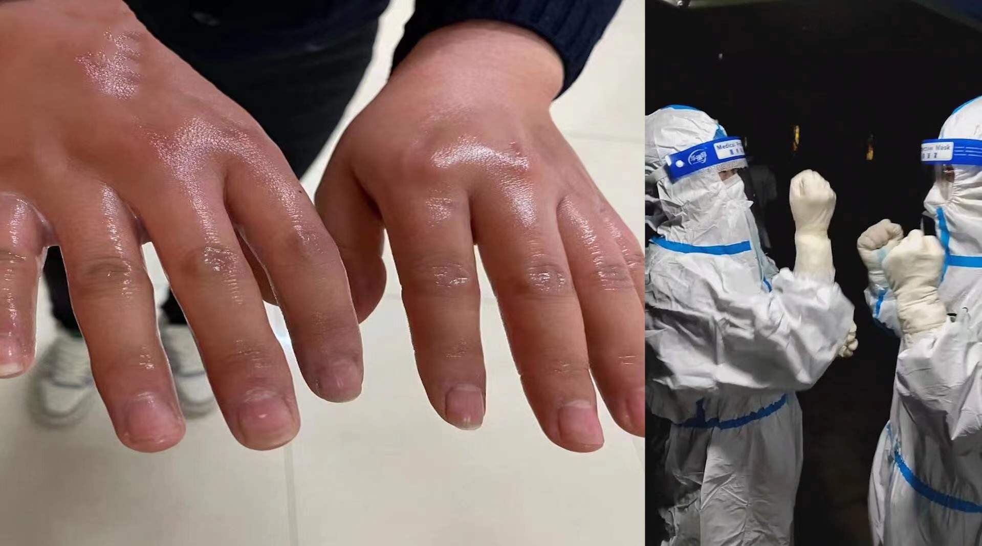 2021年疫情一线人员的奉献与坚守，2021年疫情期间医护人员的感人故事